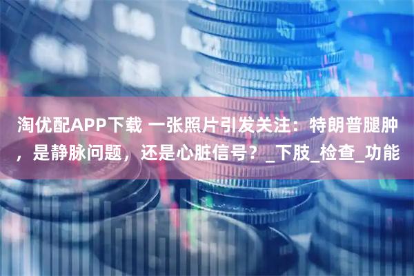 淘优配APP下载 一张照片引发关注：特朗普腿肿，是静脉问题，还是心脏信号？_下肢_检查_功能